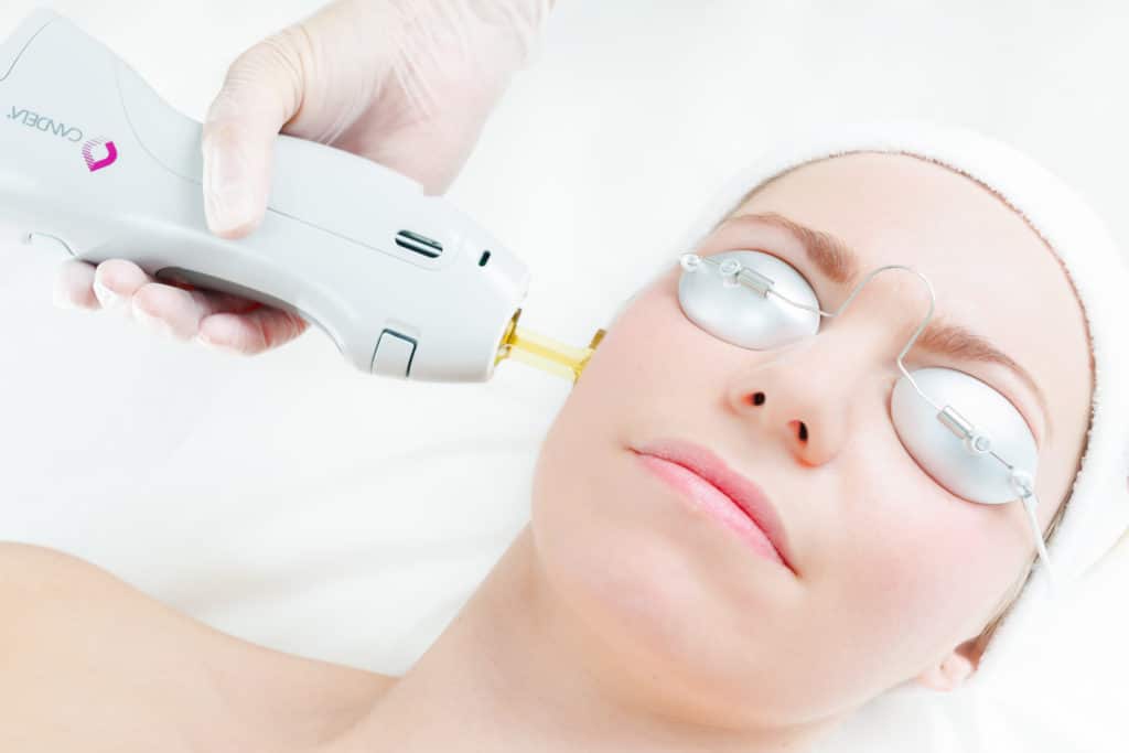 Utah north ogden laser hair removal