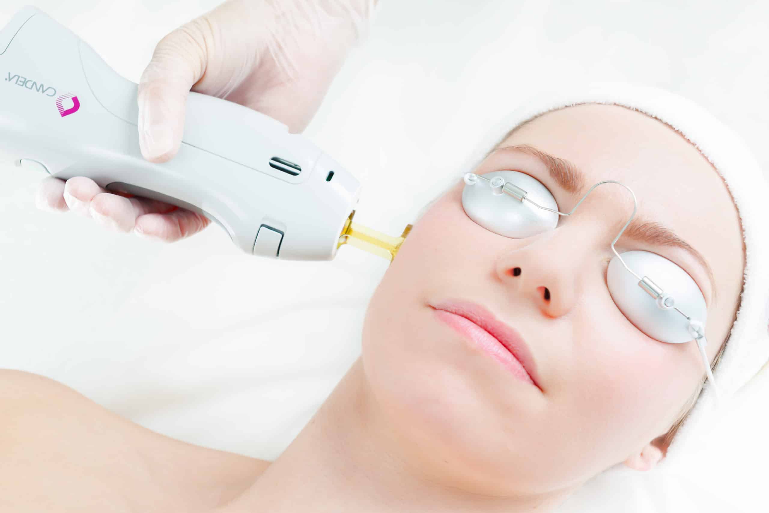 Laser Hair Removal 2 scaled