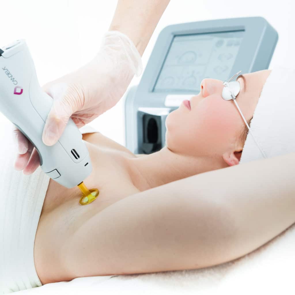What I Wish I Knew Before Starting Laser Hair Removal What I Wish I Knew Before Starting Laser Hair Removal