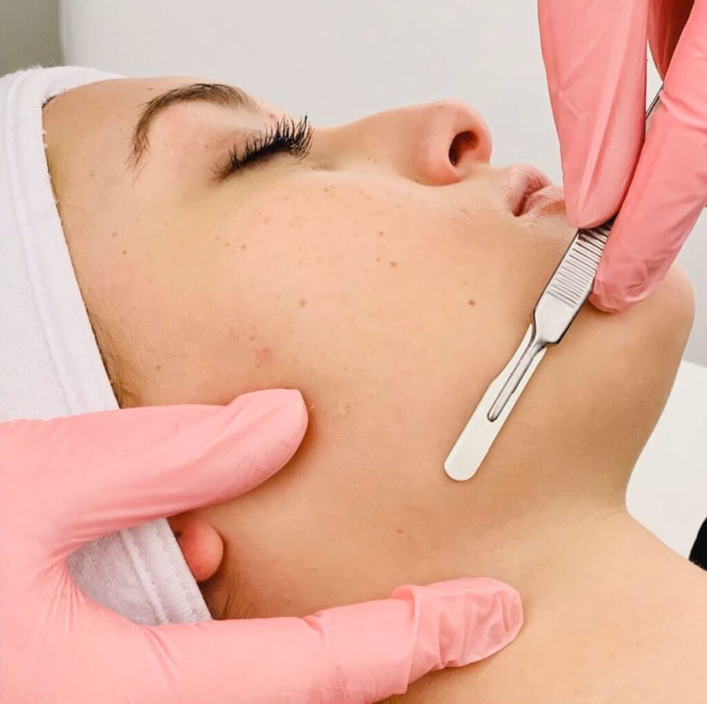 Dermaplaning dermaplaning north ogden utah